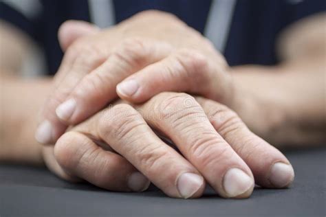 Rheumatoid Arthritis Hands Stock Image Image Of Fingers 41407123