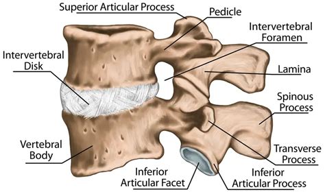 What Is Foraminal Stenosis Causes Symptoms And Treatment