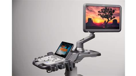 Acuson Juniper Ultrasound System Siemens Healthineers India