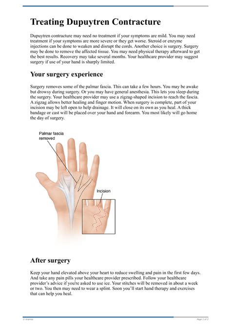 Text Treating Dupuytren Contracture HealthClips Online