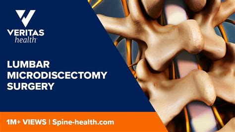 Lumbar Microdiscectomy Surgery Youtube