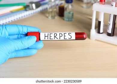 Herpes Simplex Prevention Photos and Images | Shutterstock