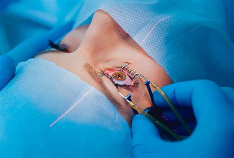 Does Medicare Cover Cataract Surgery? - Medicare Hope
