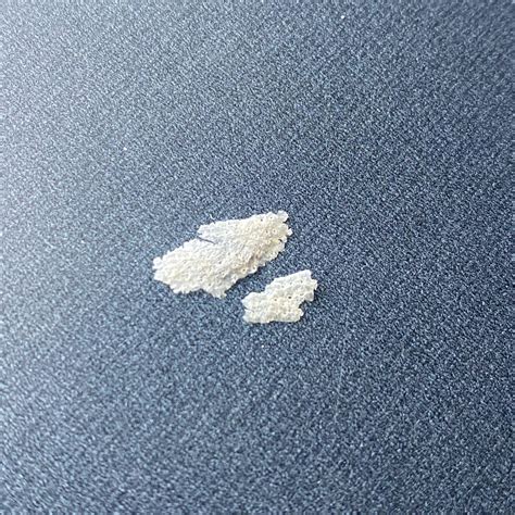 White/clear flake with yellow stain. These come off like every other