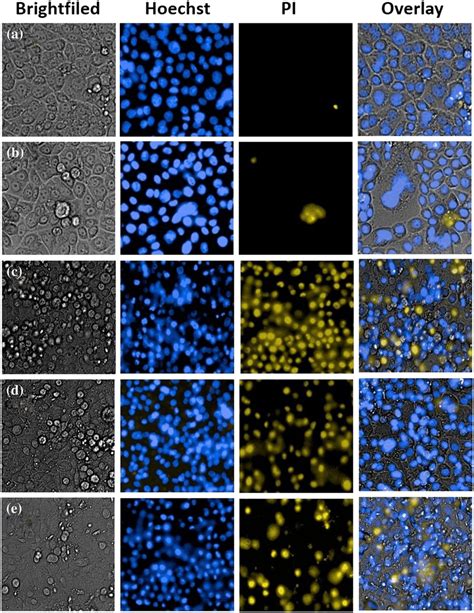 Hoechst 33342 PI Staining Of AGS Human Gastric Cancer Cells Treated