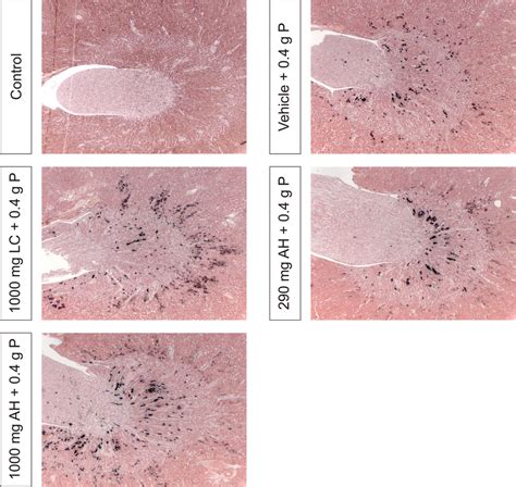 Von Kossa Stained Renal Sections Representative Of Each Treatment Download Scientific Diagram