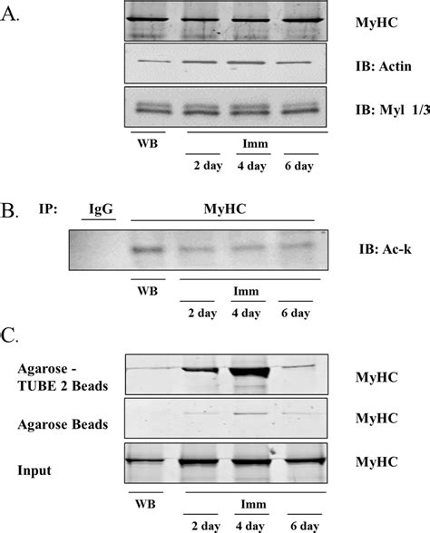 Myosin Heavy Chain Myhc Levels Acetylation And Ubiquitination In