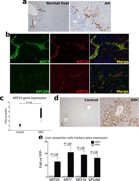 Identification Of Krt As A Marker Of Ductular Cells In Ah A