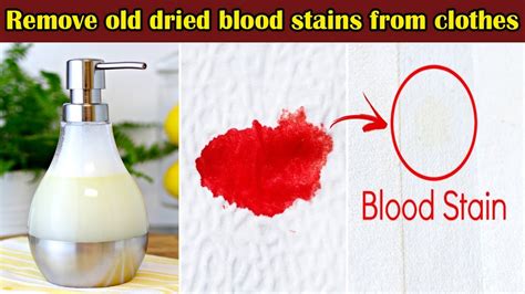 How To Remove Old Dried Blood Stains From White Shirts And Clothes