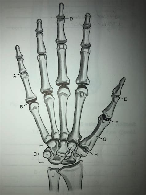 Chapter Upper Extremity Fig Anterior Aspect Of Hand And Wrist