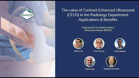 Adrian Lim Webinar Welcome And Brief Introduction On The Role Of Ceus