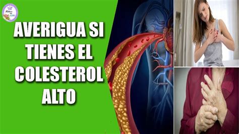 ¿tienes El Colesterol Alto Averígualo Con Estos 10 Síntomas Youtube