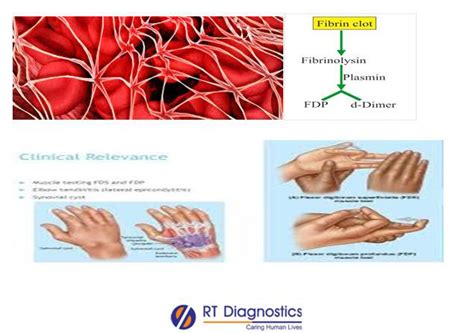 FDP RT Diagnostics