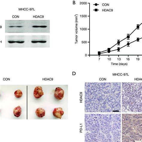 Hdac Overexpression Promotes Hcc Cell Growth In Vivo A Western Blot