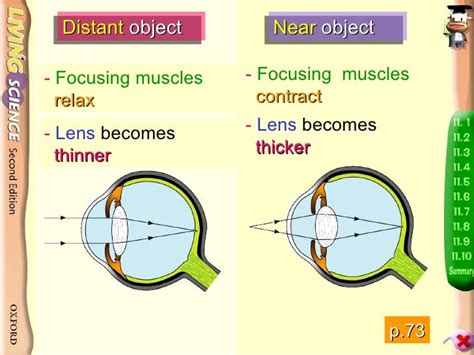 Physio Eye 1