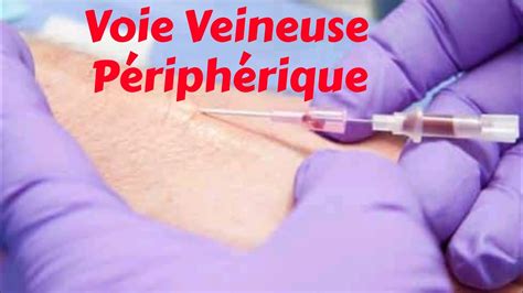 La prise de voie veineuse Cathéter veineux périphérique périphérique