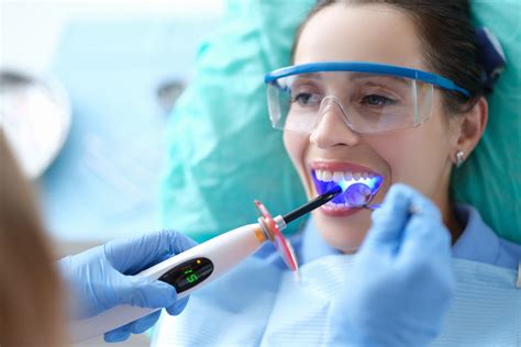 Understanding the Cavity Filling Process: What to Expect at the Dentist ...