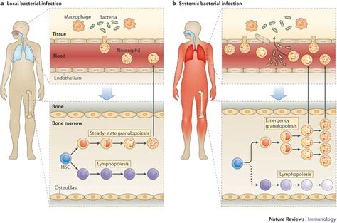 Local vs systemic infection | Bacterial infection, Infections, Immunology