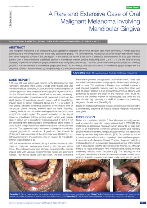 Pdf A Rare And Extensive Case Of Oral Malignant Melanoma Involving