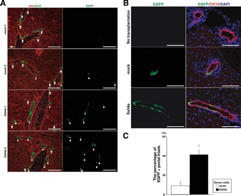 Sall4 Regulates Cell Fate Decision In Fetal Hepatic Stem Progenitor