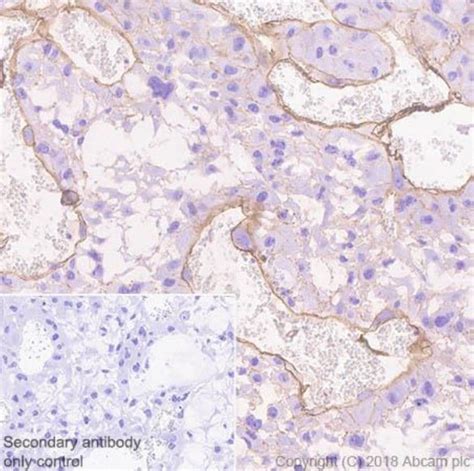 Recombinant Anti Alpha Dystroglycan Antibody 45 3 Ab199768 Abcam