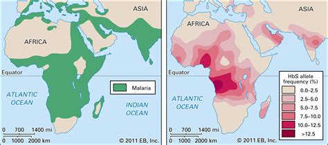 Sickle Cell Anemia Symptoms Sickle Cell Trait And Treatment Britannica