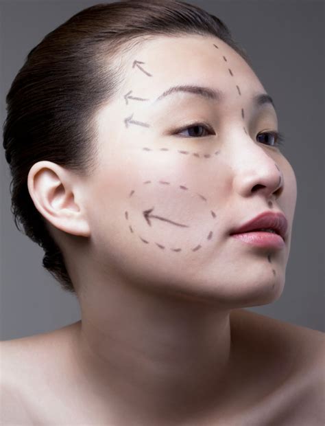 Transforming Your Appearance Through Plastic Surgery In The Bronx