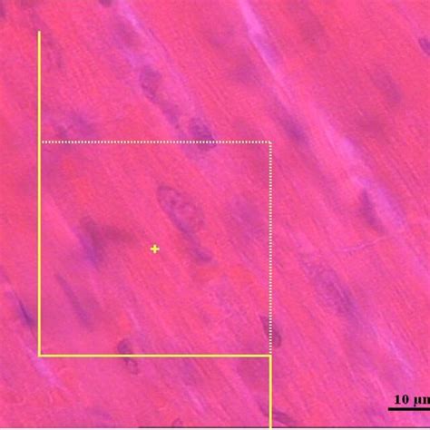 The Dissector Method For Numerical Density Of Cardiomyocytes Nuclei