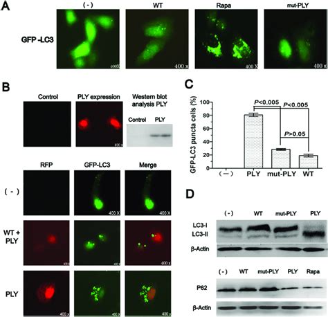 Pneumococcal Ply Is Involved In Initiating Autophagy A549 Cells Were