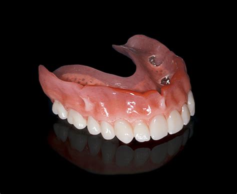 Implant Removable Denture Westbrook