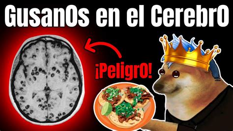 EL PELIGR0 DE COMER TAQUITOS EN LA CALLE La Neurocisticercosis YouTube