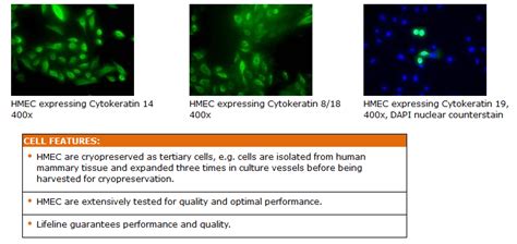 Normal Human Mammary Epithelial Cells — Female 正常人乳腺上皮細胞—女性 慧技科學有限公司