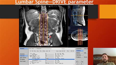 Basics Of Mri Advanced Img Breast Mri Youtube