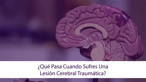 ¿qué Pasa Cuando Sufres Una Lesión Cerebral Traumática Abogados De