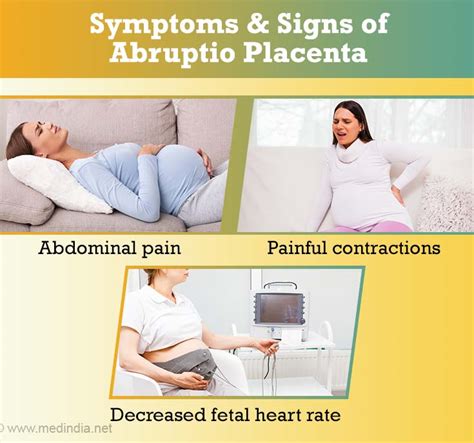 Placental Abruption Abruptio Placentae Causes Clinical Features