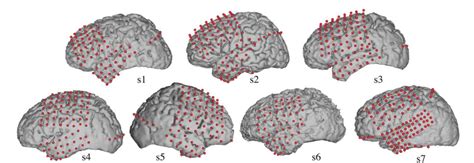 Figure 1 From Decoding Spectrotemporal Features Of Overt And Covert