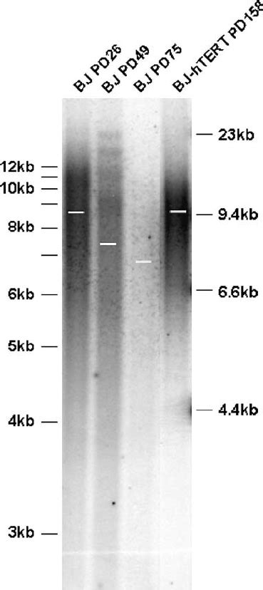 Decreased Telomere Length With Age In Human Fibroblasts Cultured