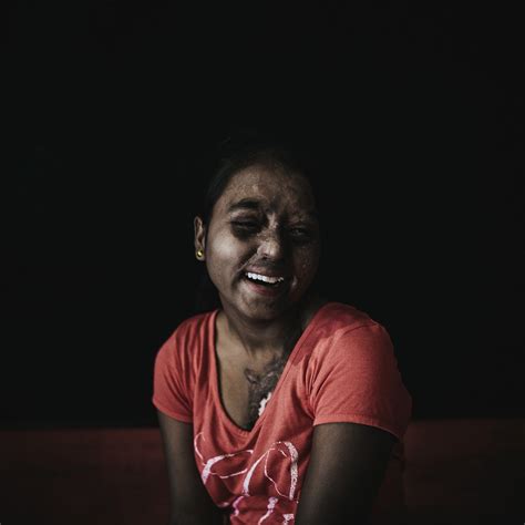 The Stories Of India S Acid Attack Survivors