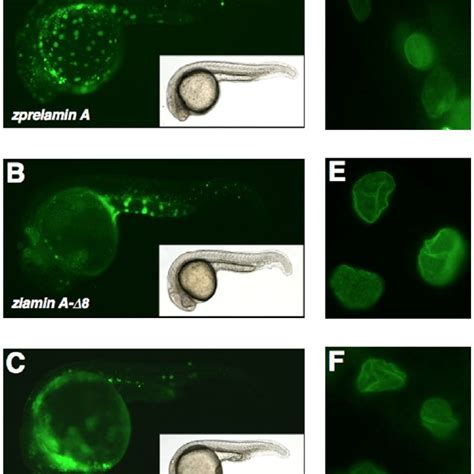 Expression Of Egfp Tagged Zprelamin A Zlamin A D And Zlamin A D