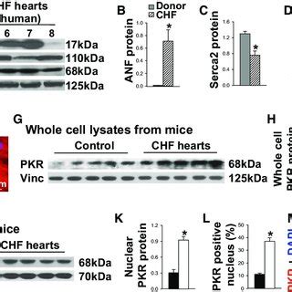 Double Stranded Rnadependent Protein Kinase Pkr Deficiency