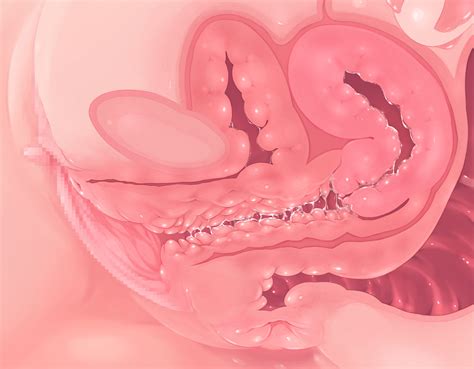 Hentai X Ray Xray X Ray Cross Section Uterus Cervix Internal Pics