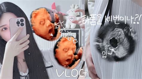 Vlog 임신 28주 임산부 일상 하품하는 태아👶🏻드디어 입체초음파 성공 Youtube