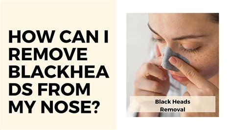 How can I remove blackheads from my nose? - Rakshaa_clinic - Medium