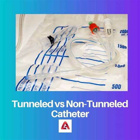 Tunneled vs Non-Tunneled Catheter: Difference and Comparison