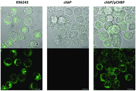 Confocal Micrographs Of Chbp Expression And Localization In U937 Cells Download Scientific