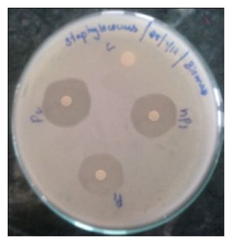 Inhibition Zones Produced By Biosynthesized Agnps Against Different