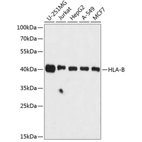 Anti Hla Class 1 Abc Antibody A8902