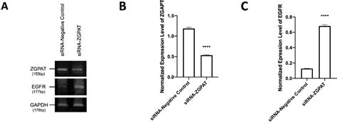 Figure From Rnai Based Gene Therapy Targeting Zgpat Promotes Egf