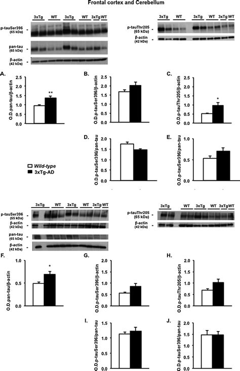 Tau And Phosphorylated Tau Levels Were In The Frontal Cortex And