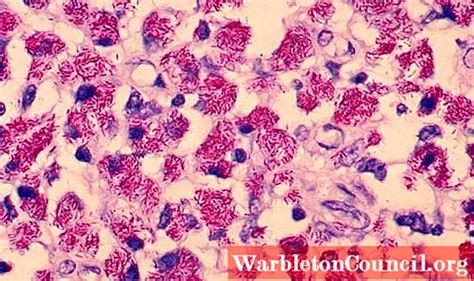 Mycobacterium avium complex: characteristics and morphology - science ...